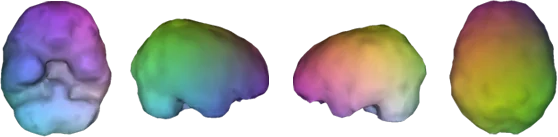 Healthy Brain Scan